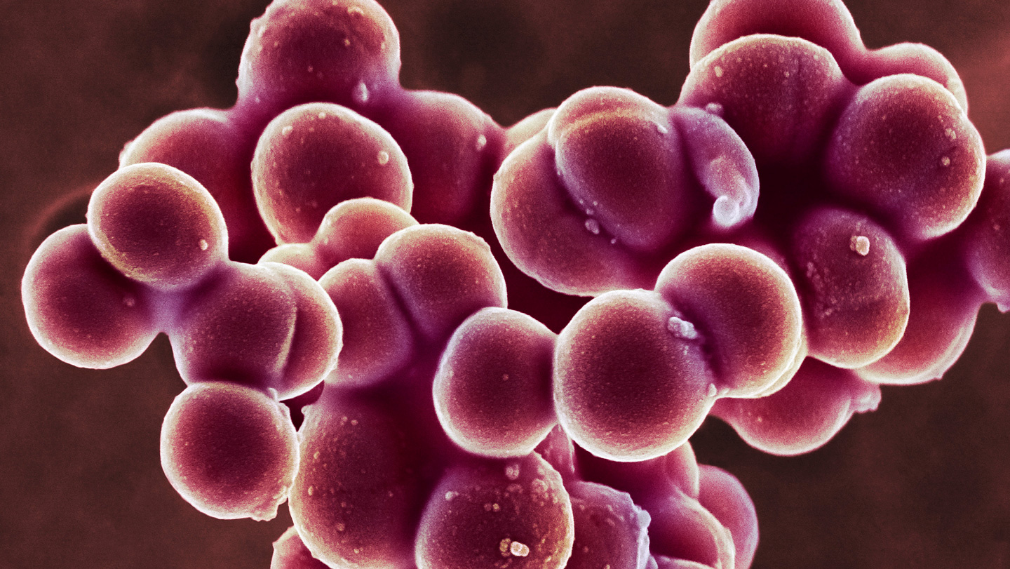 091725_EG_staph.jpg